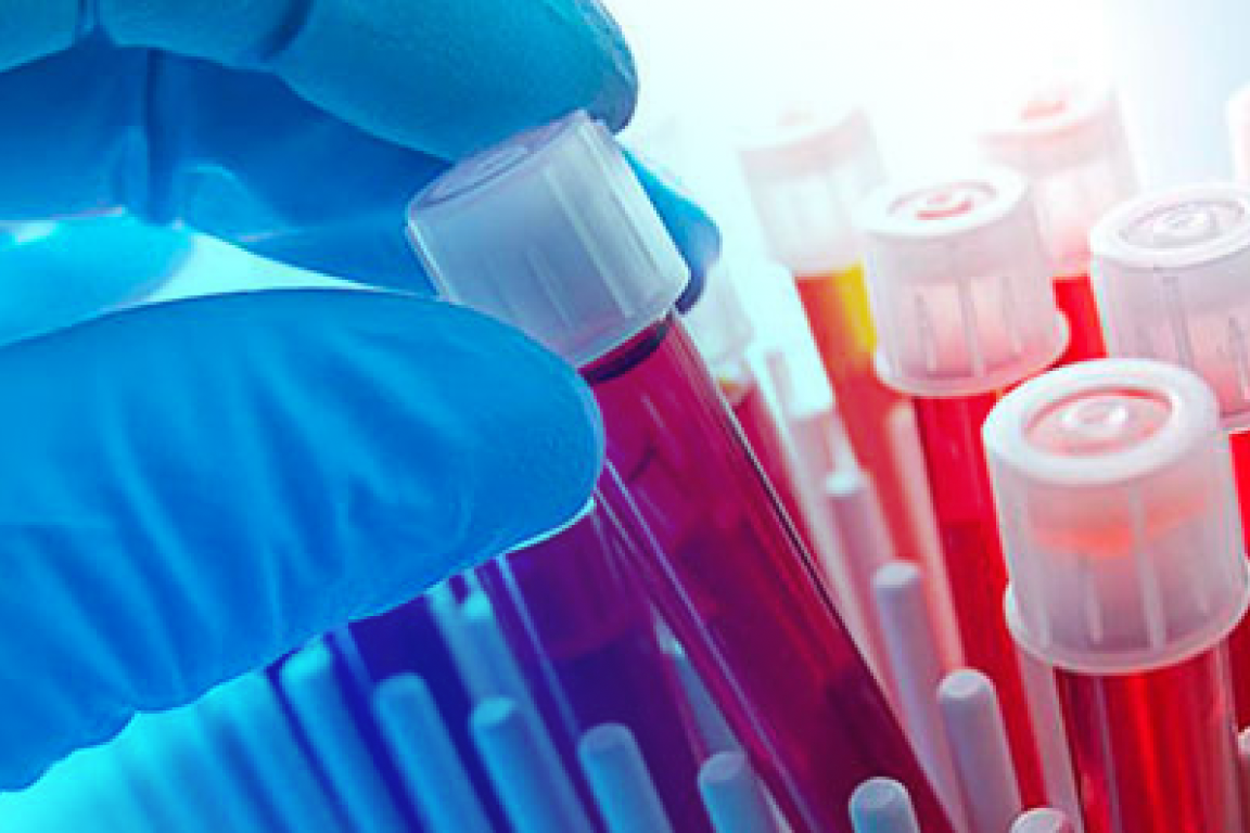 Hematologia Clínica e Banco de Sangue